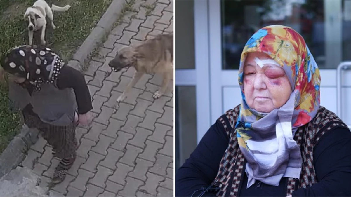 Köpeklerden kaçarken düşen yaşlı kadın tanınmaz hale geldi