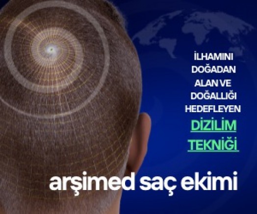 Türk Bilim İnsanları örümceklerden ilham alarak saç ekiminde yeni yöntem geliştirdiler:  'Arşimed Saç Ekimi Tekniği'